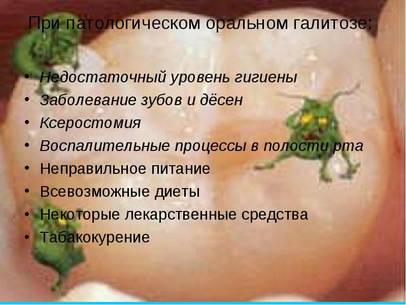 Галитоз | lemur59.ru